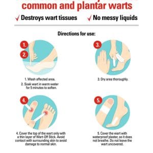 Wart Off Stick 5g - Image 3