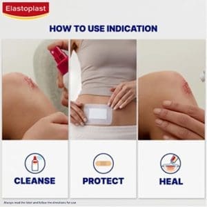 Elastoplast Dressing Green And Protect Extra Strong Adhesion Dressing 1 M X 6 cm Size Beige - Image 5