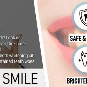 Dentagenie Professional Teeth Whitening Strips Only 30 Minutes A Day For Tooth Whitening Perfection Strong 6 Hydrogen Peroxide Gel For Whiter Teeth 28 Moldable Upper And Lower No Slip White Strips - Image 8