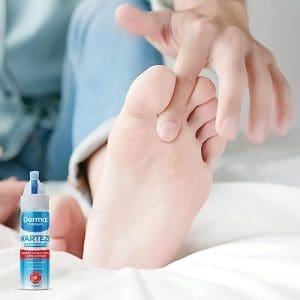 Dermal Therapy Warteze 75ml - Image 7